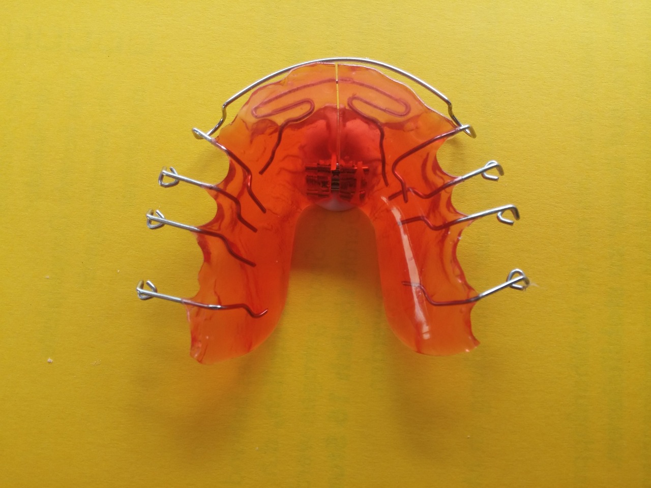 牙齒深覆合矯正價格詳解，影響因素與費(fèi)用分析指南